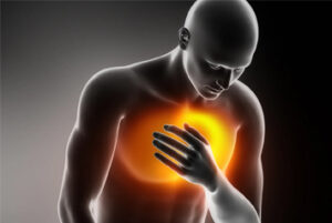 Non-Cardiac-Chest-Pain